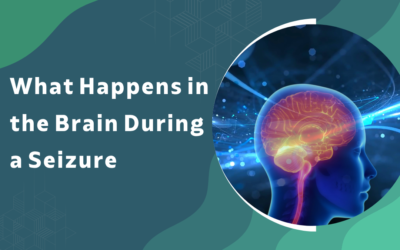 What Happens in the Brain During a Seizure?