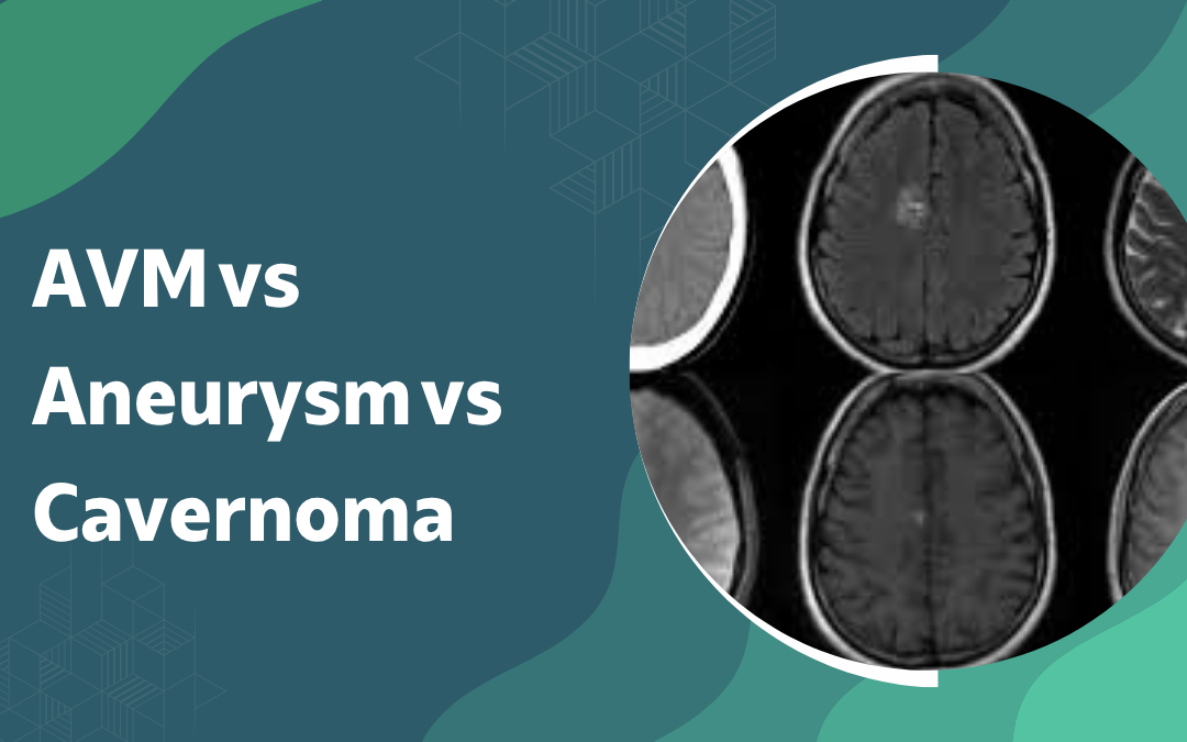 AVM vs Aneurysm vs Cavernoma