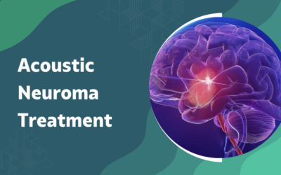 Radiosurgery vs Open Surgery: Which for Acoustic Neuroma?