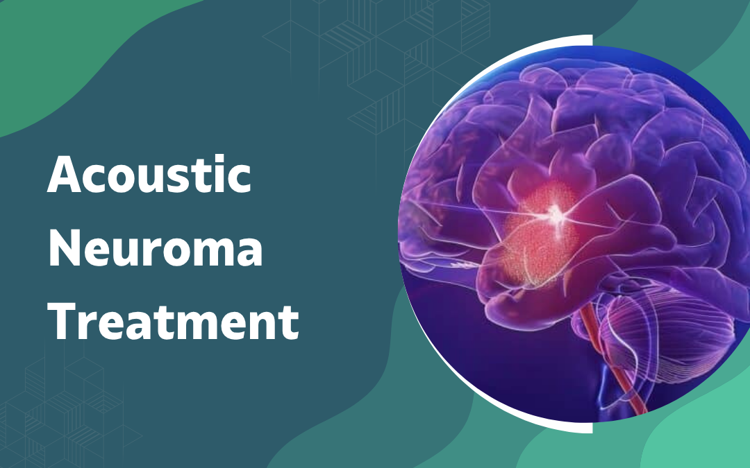Acoustic Neuroma Treatment