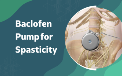 How Does a Baclofen Pump Treat Spasticity?