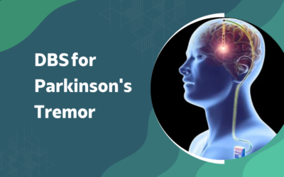 Can DBS Surgery Stop Parkinson’s Tremors?