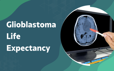 What Is Glioblastoma Life Expectancy?