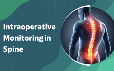 What Is Intraoperative Monitoring in Spine Surgery?
