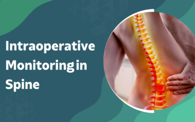 What Is Intraoperative Monitoring in Spine Surgery?