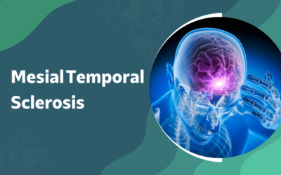 What Is Mesial Temporal Sclerosis and Can It Be Cured?