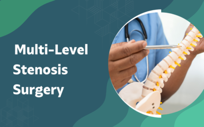 Multi-Level Stenosis: Is Fusion Surgery Always Needed?