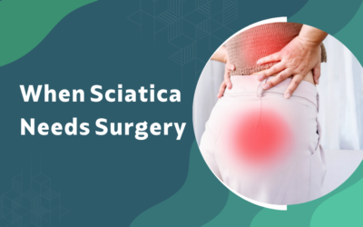Sciatica: When Is Surgery Needed Instead of Physiotherapy?