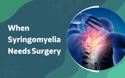 When Does Syringomyelia Actually Need Surgery?