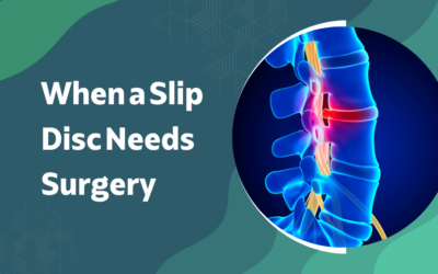 When a Slip Disc Needs Surgery?