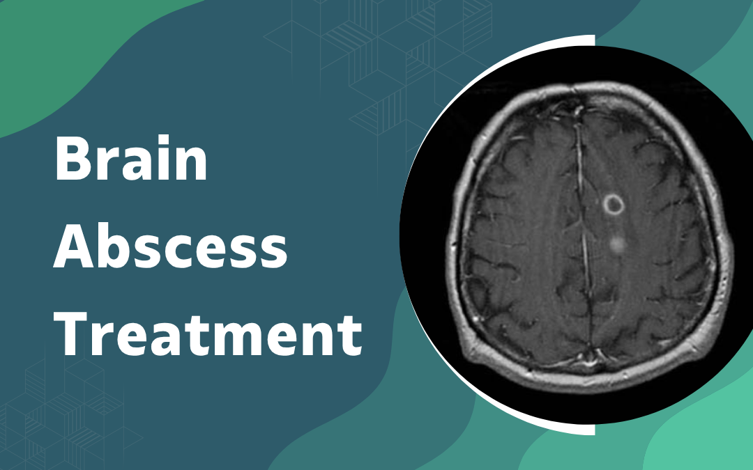 Brain Abscess Treatment