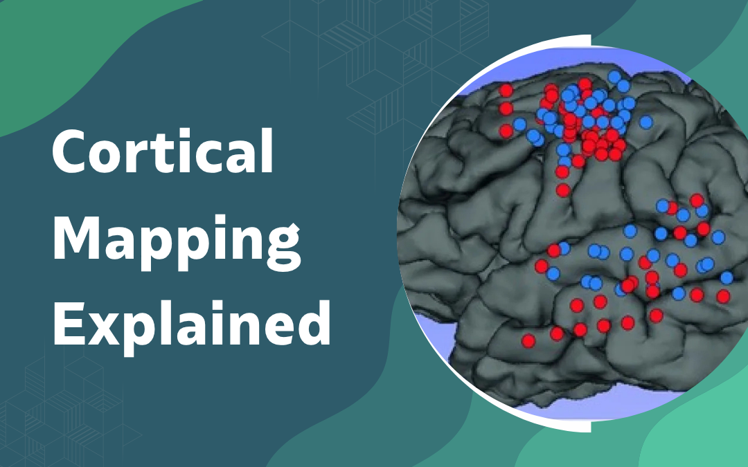Infographic titled Cortical Mapping Explained with a brain diagram showing red and blue markers on cortical regions.