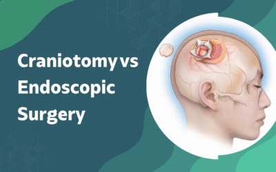 Craniotomy vs Endoscopic Surgery: Which Is Safer?