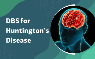 DBS for Huntington’s Disease: Does It Work?