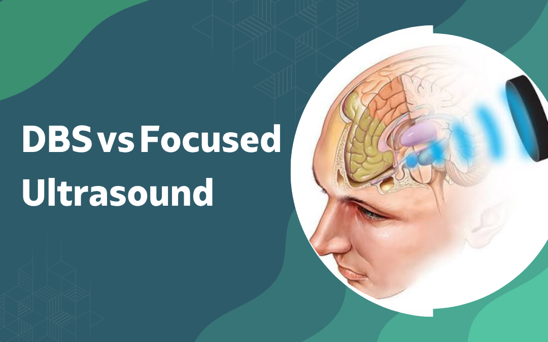 DBS vs Focused Ultrasound