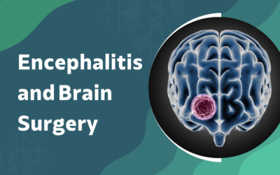 What Is Encephalitis and When Does It Need Surgery?