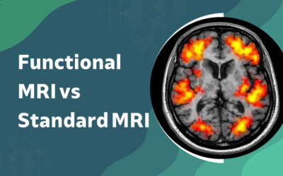 Functional MRI vs Standard MRI: Which Is Better?