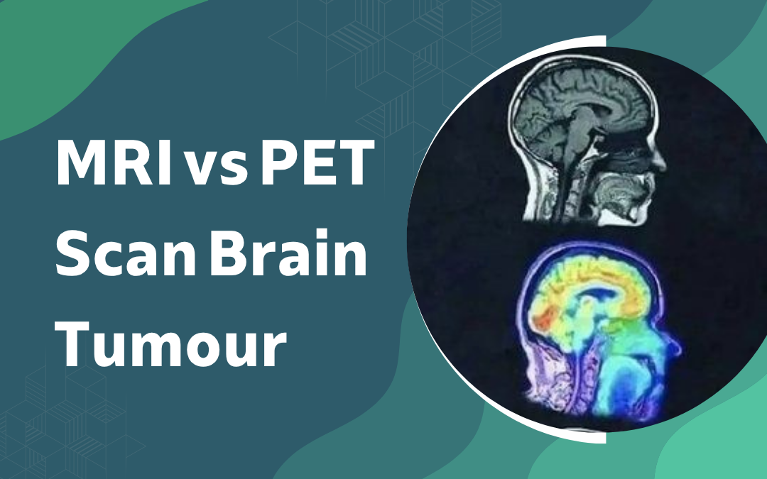 MRI vs PET Scan Brain Tumour