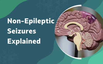 Ependymoma vs Astrocytoma: How Is Treatment Different?