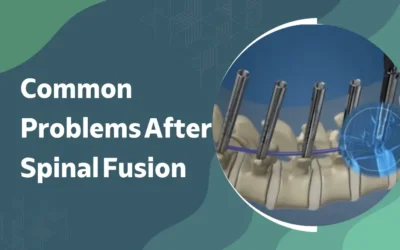 Common Problems After Spinal Fusion