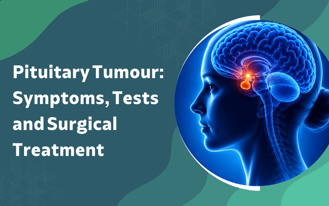 Informational graphic about pituitary tumour symptoms, tests and surgical treatment, featuring a blue brain illustration with the pituitary highlighted beside the title text.