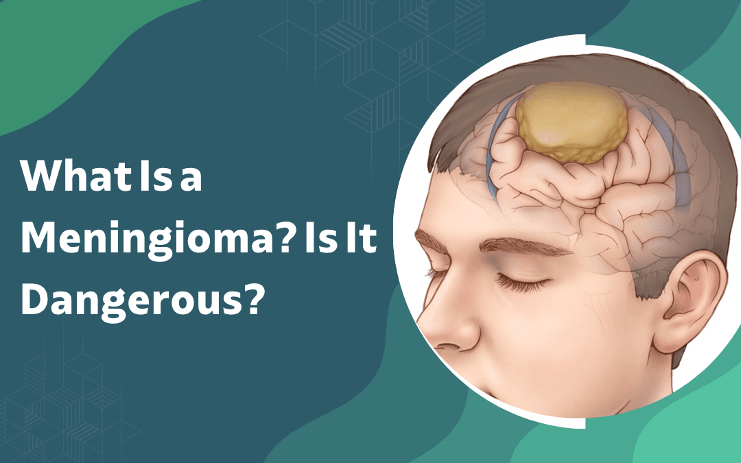 Banner with teal abstract background and a circular illustration of a head showing the brain; title reads 'What Is a Meningioma? Is It Dangerous?'
