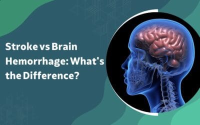 Stroke vs Brain Hemorrhage: What’s the Difference?