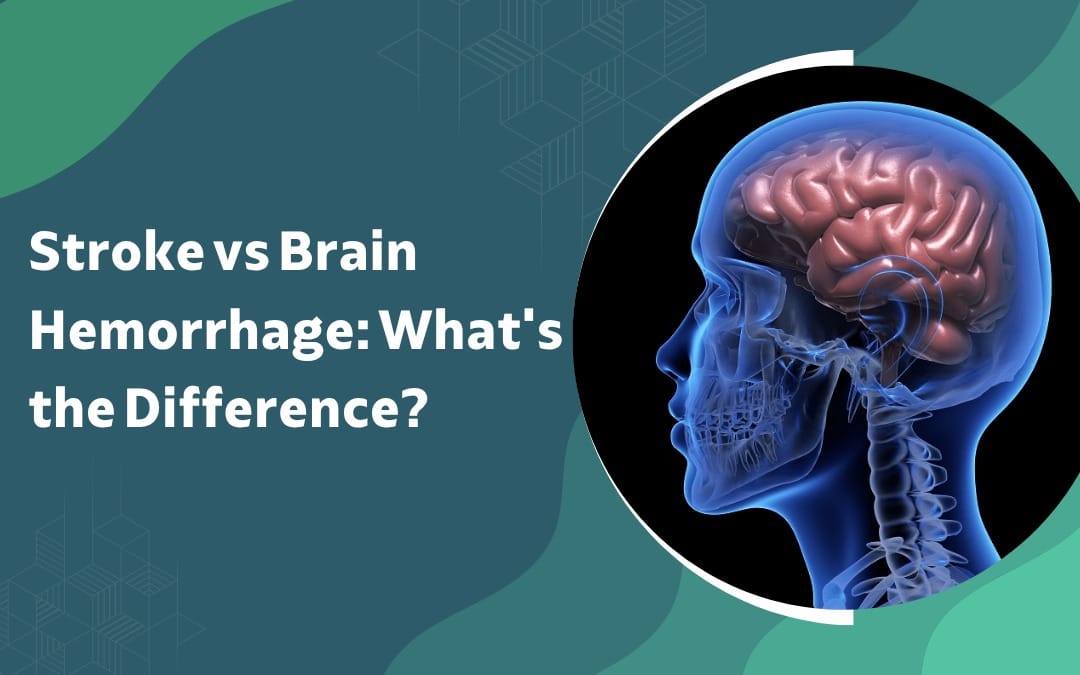 Stroke vs Brain Hemorrhage: What's the Difference?