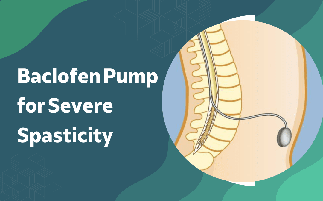Baclofen Pump for Severe Spasticity