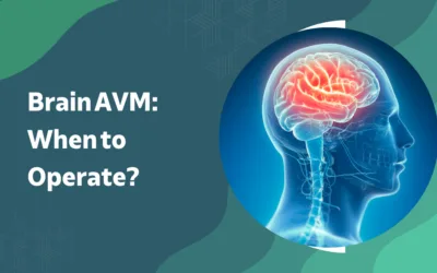 Brain Arteriovenous Malformation: When to Operate?