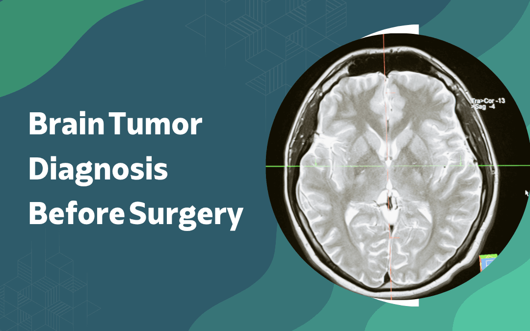 How Is Brain Tumor Diagnosed Before Surgery?