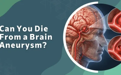 Can You Die From a Brain Aneurysm?