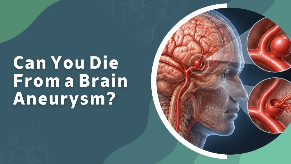 Can You Die From a Brain Aneurysm? article cover showing brain anatomy and arterial diagrams in a circular collage.