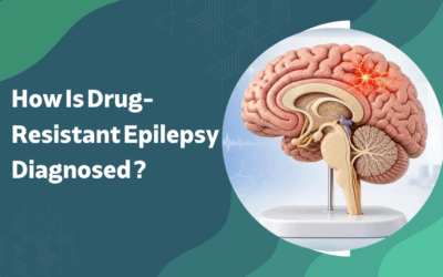 How Is Drug-Resistant Epilepsy Diagnosed?