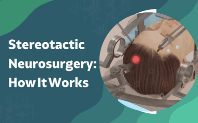 What Is Stereotactic Neurosurgery and How Does It Work?