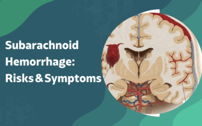 What Is Subarachnoid Hemorrhage and Is It Fatal?