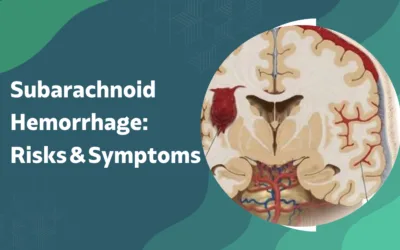 What Is Subarachnoid Hemorrhage and Is It Fatal?