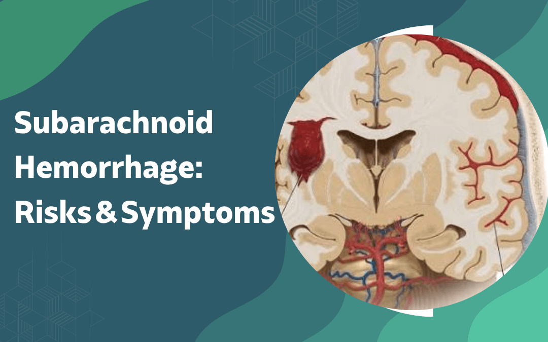 Subarachnoid Hemorrhage Risks Symptoms