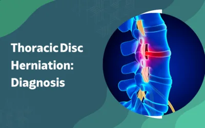 Thoracic Disc Herniation: Why It’s Harder to Diagnose?