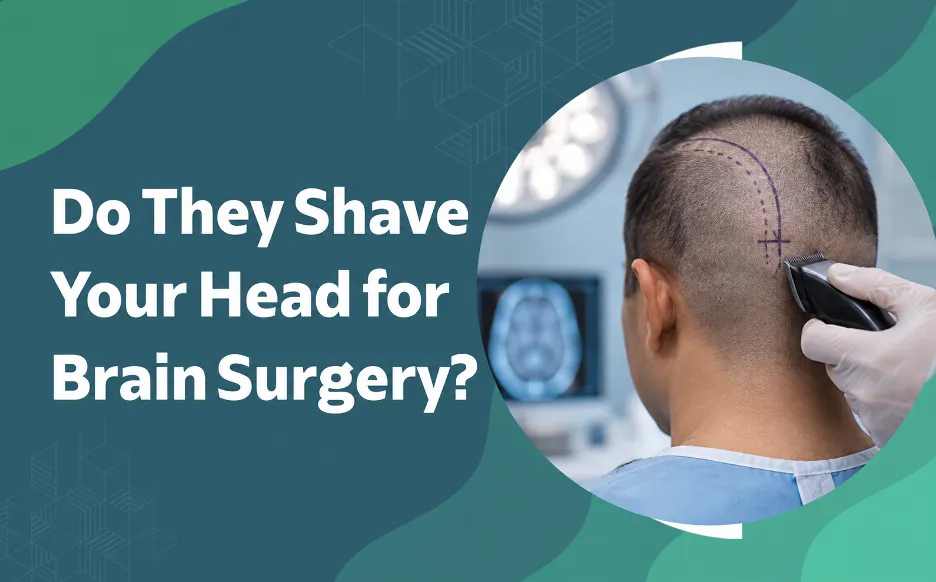Questioning article cover: 'Do They Shave Your Head for Brain Surgery?' with a surgeon shaving a patient’s head for brain surgery prep in a round photo.
