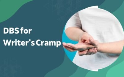 Can DBS Help Writer’s Cramp and Task-Specific Dystonia?