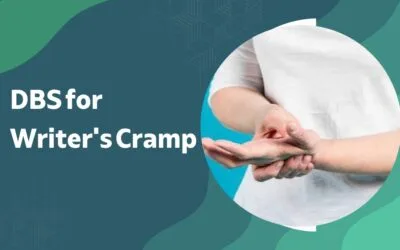 Can DBS Help Writer’s Cramp and Task-Specific Dystonia?